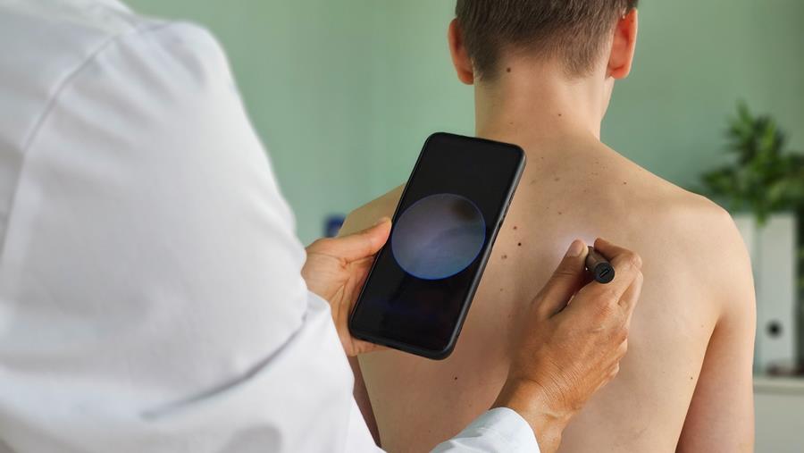 Cancer de la peau: l'app' SkinVision loupe des lésions et donne de faux positifs